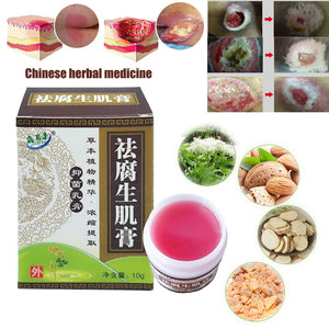 ZB Chinese Herbal medicine removal rot myogeniccream bedsores paste treat pressure sores ulcer festering wound healing